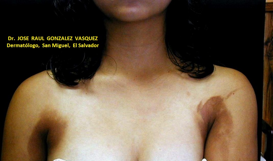 FOTOTOXICIDAD - COSMETICOS