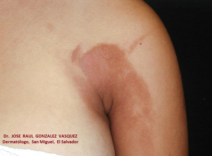 FOTOTOXICIDAD - COSMETICOS