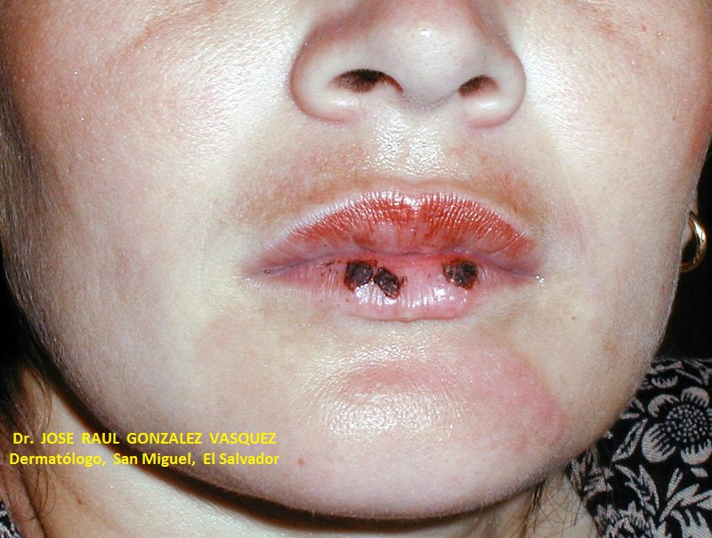 FOTOTOXICIDAD - COSMETICOS