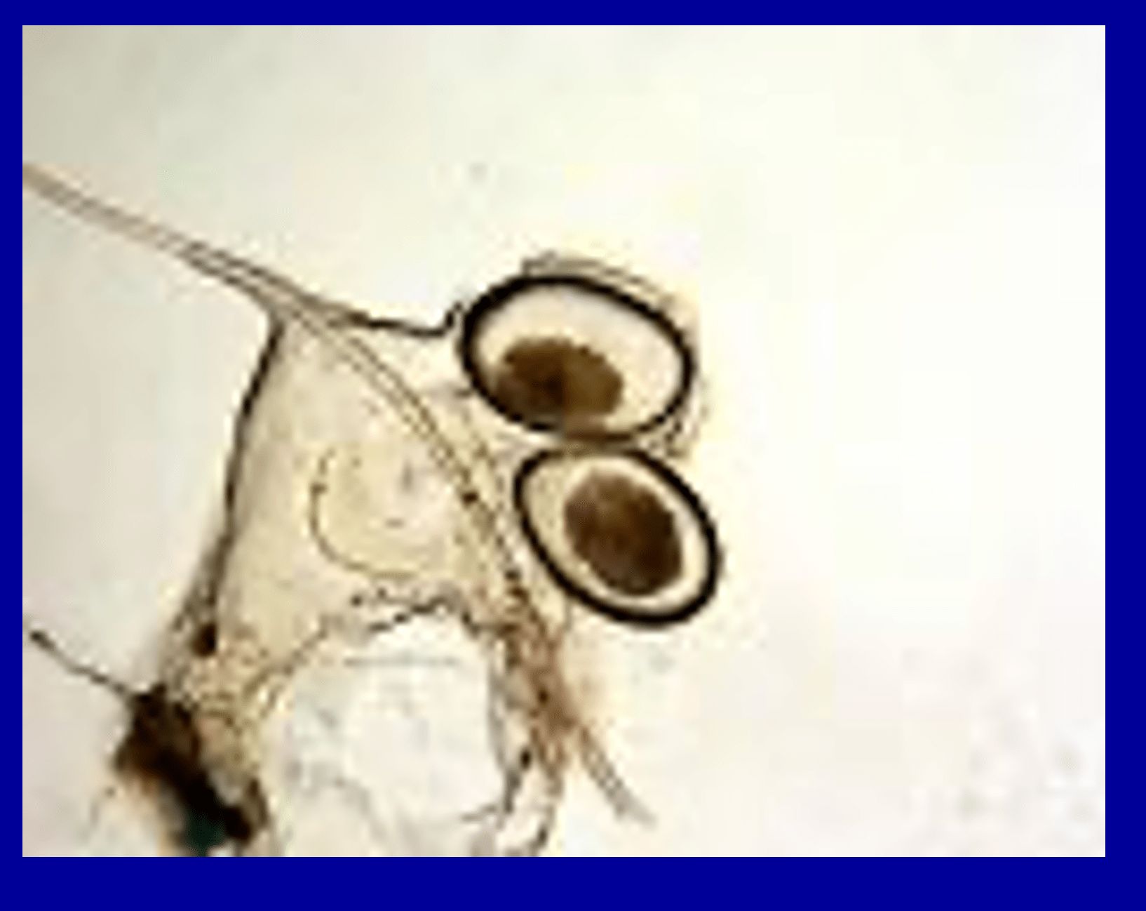 HUEVOS DE SARCOPTES SCABIEI