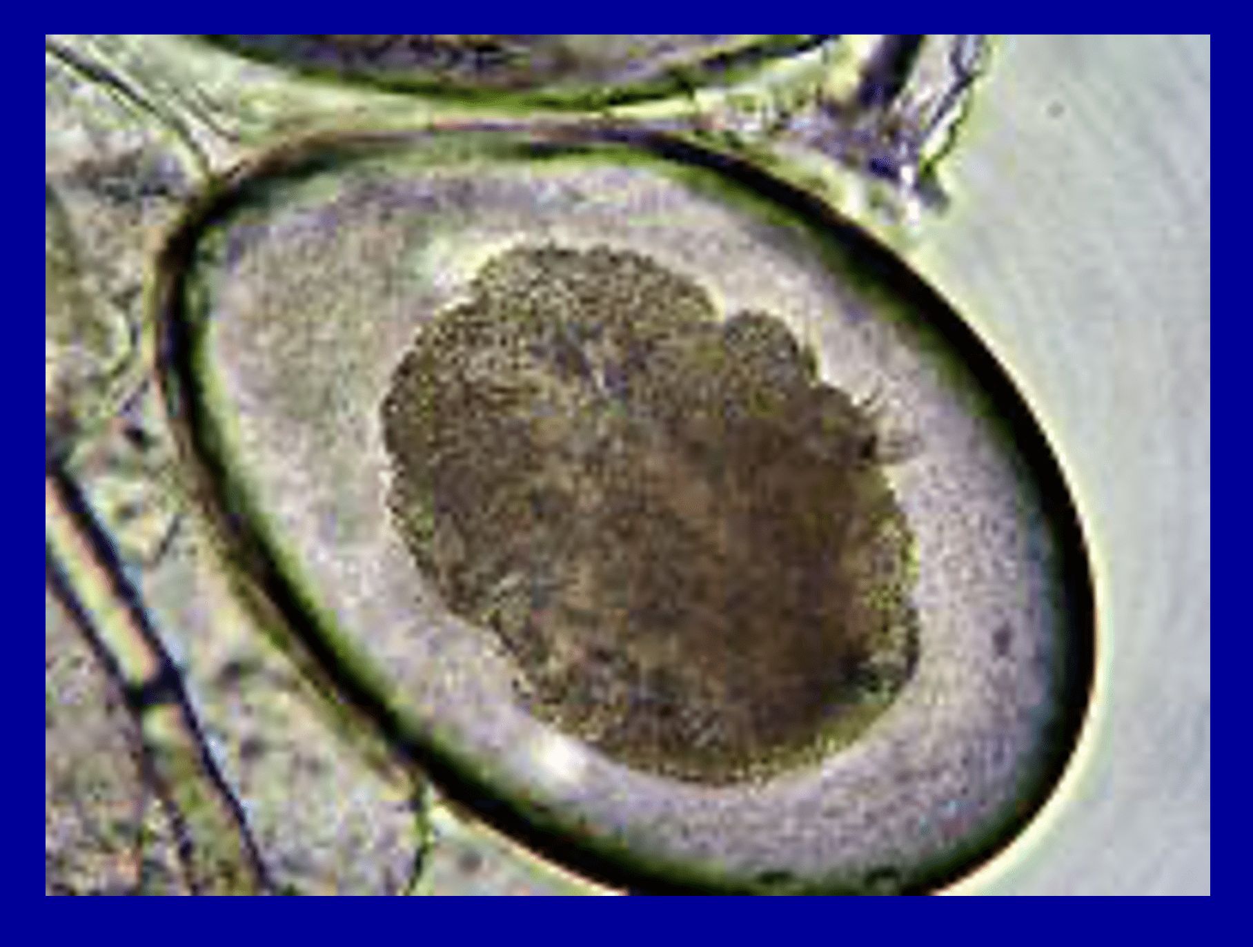 HUEVOS DE SARCOPTES SCABIEI